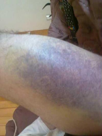 muslo 2