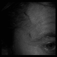 Cote en la cara por quillazo en un pagon.